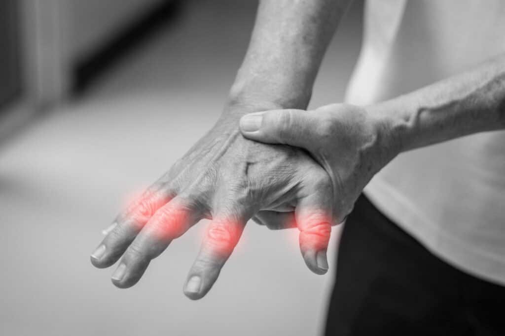 Rheumatoid Arthritis | Hand Pain