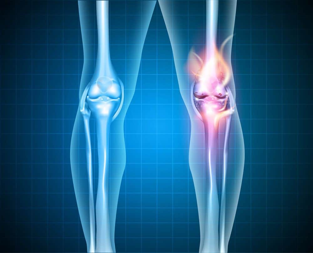 Radial Meniscus Tear Treatments