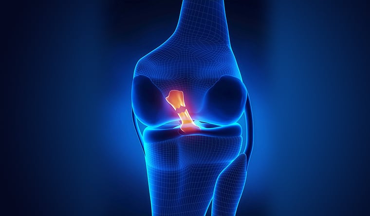 Can an ACL Tear Heal Without Surgery?