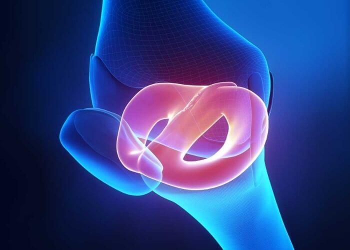 Radial Meniscus Tear Repair