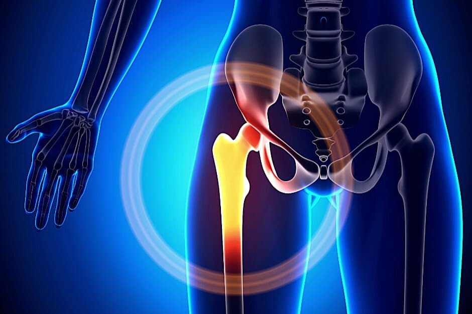 Stem Cell Therapy for Hip Labral Tears