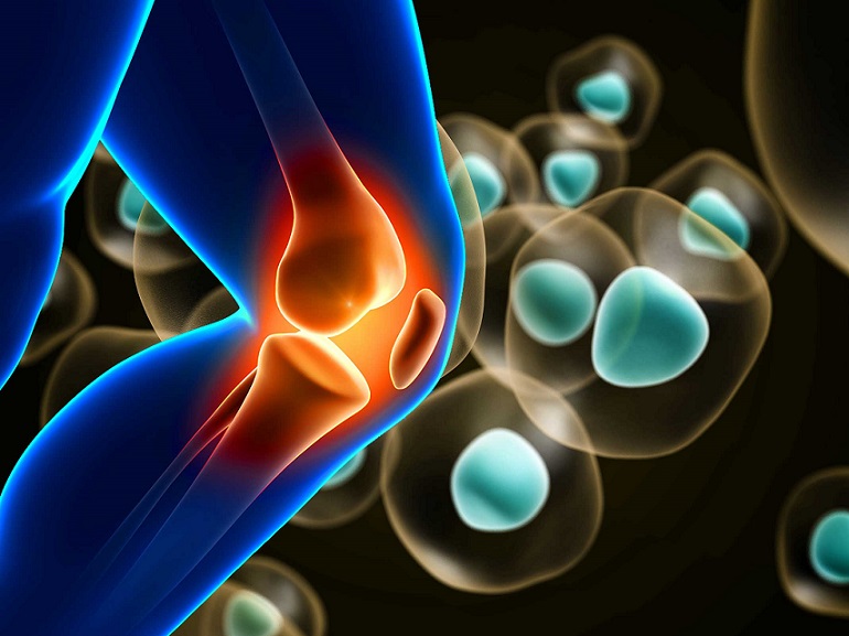 stem cell therapy for knees covered by insurance 2